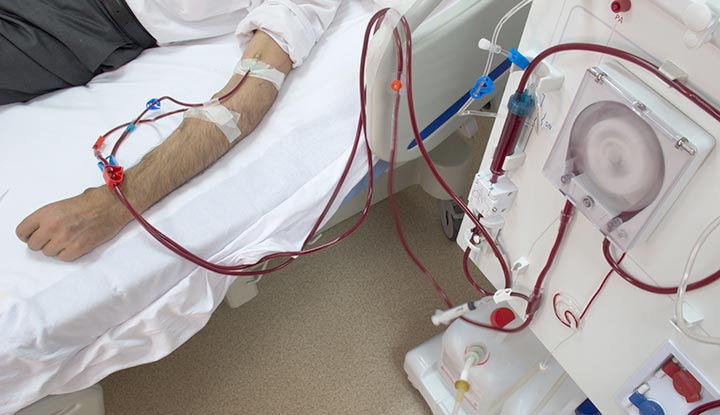 ڈائلیسس کا مریض